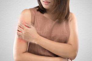 malaria prevention