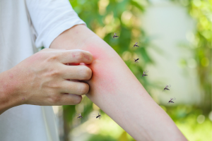 malaria prevention